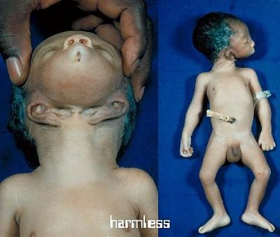 baby_13.jpg