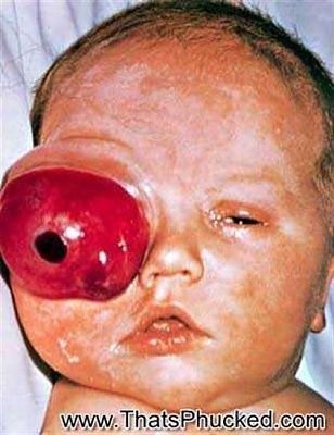 keep-eye-baby-5242590f-e.jpg