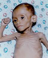 starve2.jpg