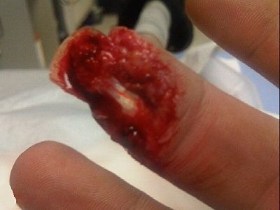 finger.jpg