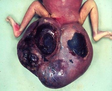 deformedfetus8.jpg