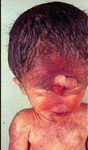 deformedfetus9.jpg