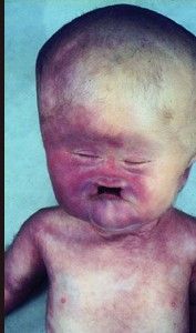 deformedfetus10.jpg