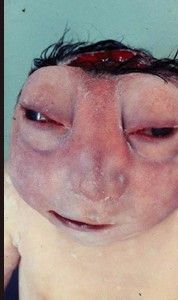 deformedfetus12.jpg