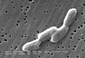 salmonella two.jpg