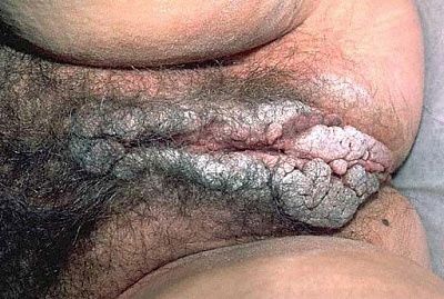 hole-you-dont-want-find.jpg