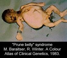 prune belly5.jpg