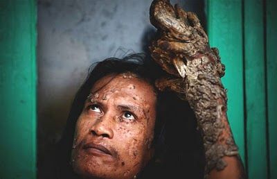 tree man 3.jpg