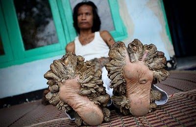 tree_man_7.jpg