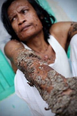 tree_man_12.jpg