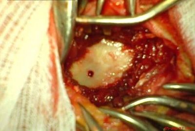 nail5.jpg