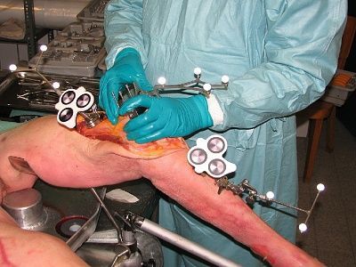 kneesurgery.jpg