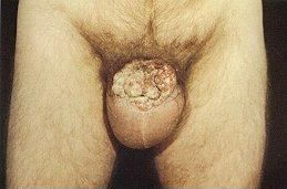 cocks3.jpg