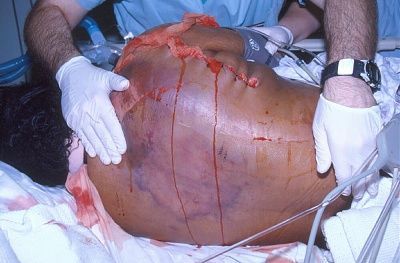 case8a.jpg