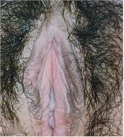 Name:  lichen1250 (1).jpg
Views: 20280
Size:  31.9 KB