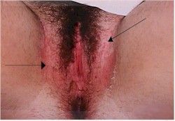 Name:  monilia250.jpg
Views: 19888
Size:  13.2 KB