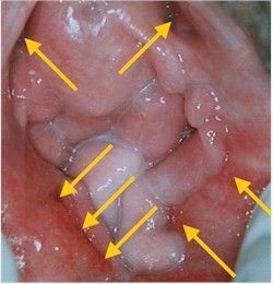Name:  vestibulitis6250.jpg
Views: 19623
Size:  20.4 KB