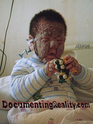 cen_coralskinnedboy_01.jpg