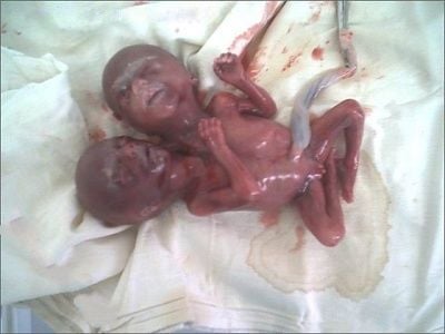 deformed-baby.jpg