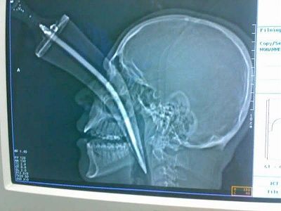 knife-face-1.jpg