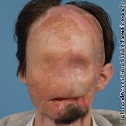 1300815694_Face Transplant.jpg