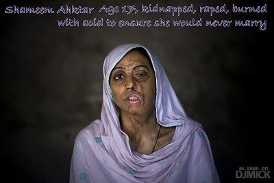 ahktar-shameem-raped-burned-17.jpg