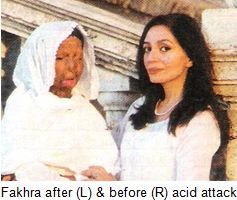 Fakhra-acid-attack-victim-pakistan after & before.jpg