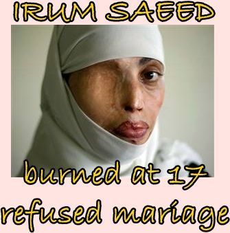 SAEED, IRUM burned at 17 refused marriage.jpg