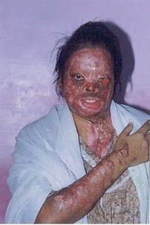 VICTIM ACID3.jpg