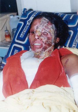 VICTIM ACID.jpg