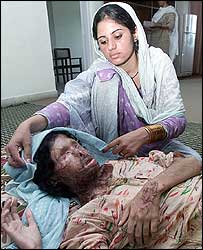 1 Zarina Ramzan,  18 yr old mother of baby, burned by neighbor.jpg