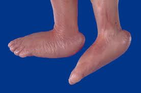 TRIS 13 ROCKER BOTTOM FEET.jpg