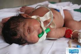 cyclopia1.jpg