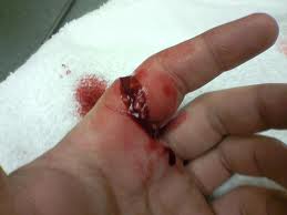 cuts8.jpg