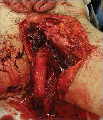 jemergtraumashock_2010_3_2_199_62110_u1.jpg