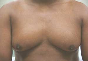 Donaway-Preop.jpg
