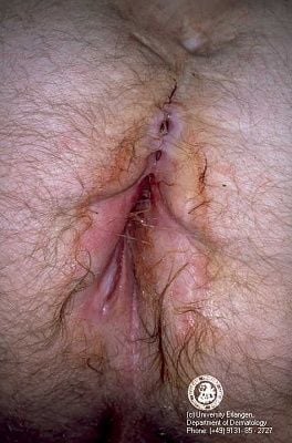 img0038.jpg