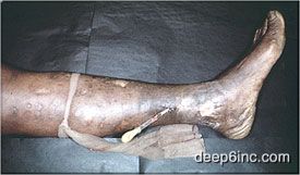 her05-1.jpg