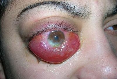 eye.jpg