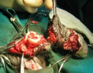 penis-cancer-2-300x236.jpg