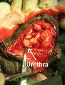penis-cancer-3-230x300.jpg
