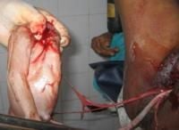 locked-twins-4_thumbnail.jpg