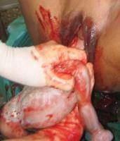 locked-twins-9_thumbnail.jpg