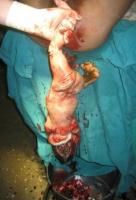 craniotomy-13_thumbnail.jpg