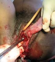 exvisceration-1_thumbnail.jpg
