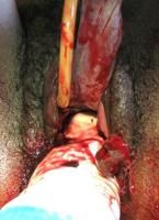 exvisceration-2_thumbnail.jpg
