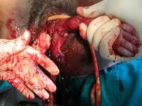 exvisceration-5_thumbnail.jpg