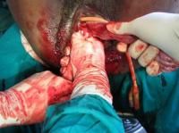 exvisceration-6_thumbnail.jpg