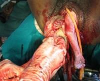 exvisceration-7_thumbnail.jpg