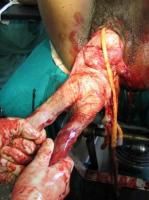 exvisceration-8_thumbnail.jpg